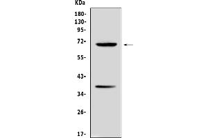 Western blot analysis of Alpha 1 Fetoprotein using anti-Alpha 1 Fetoprotein antibody (ABIN5692976). (alpha Fetoprotein Antikörper  (AA 19-254))