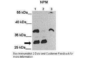 Lanes:   Lane 1: 25ug MIA PaCa-2 cell lysate Lane 2: 25ug MDA-MB-231 cell lysate Lane 3: 25ug Huh-7 cell lysate  Primary Antibody Dilution:   1:2000  Secondary Antibody:   Anti-rabbit-HRP  Secondary Antibody Dilution:   1:5000  Gene Name:   NPM1  Submitted by:   Andrei L. (NPM1 Antikörper  (C-Term))