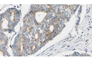 ABIN6277125 at 1/100 staining Human prostate tissue by IHC-P. (GAS2L1 Antikörper  (C-Term))