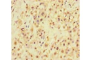 Immunohistochemistry of paraffin-embedded human placenta tissue using ABIN7168871 at dilution of 1:100 (SQSTM1 Antikörper  (AA 16-310))