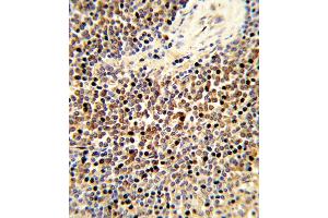 Formalin-fixed and paraffin-embedded human spleen tissue reacted with CYP24A1 Antibody (C-term), which was peroxidase-conjugated to the secondary antibody, followed by DAB staining.