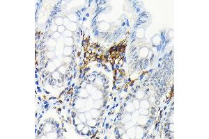 Immunohistochemistry of paraffin-embedded human colon using HLA-DRB1 Rabbit mAb (ABIN7268374) at dilution of 1:100 (40x lens). (HLA-DRB1 Antikörper)