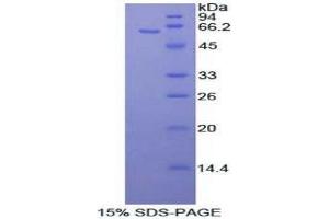 SDS-PAGE (SDS) image for Mitogen-Activated Protein Kinase Kinase 4 (MAP2K4) (AA 137-394) protein (His tag,GST tag) (ABIN2123287)