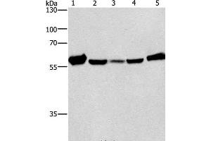 Western Blot analysis of Mouse liver tissue and Raji cell, hela, hepG2 and A549 cell using CAT Polyclonal Antibody at dilution of 1:266. (Catalase Antikörper)