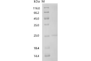 Prolactin (PRL) (AA 30-226), (full length) protein (His tag)