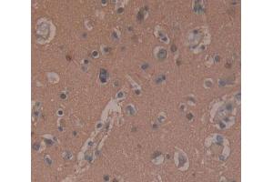 DAB staining on fromalin fixed paraffin- embedded brain tissue) (SNAP25 Antikörper  (AA 1-206))