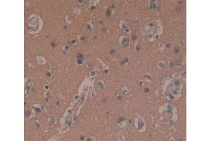 DAB staining on fromalin fixed paraffin- embedded brain tissue)