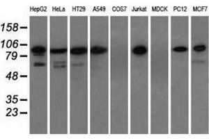 Western blot analysis of extracts (35 µg) from 9 different cell lines by using anti-TACC3 monoclonal antibody. (TACC3 Antikörper)