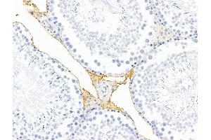 ABIN7094795 and ABIN7098846 at 1/100 staining Rat testis tissue by IHC-P. (HHIP Antikörper  (C-Term))