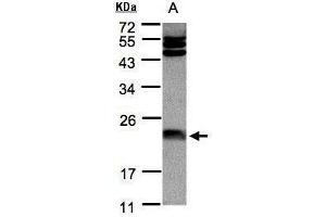 WB Image Sample(30 μg of whole cell lysate) A:Hep G2, 12% SDS PAGE antibody diluted at 1:1000 (FTL Antikörper)
