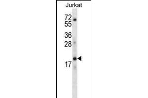 KRT3 Antibody (C-term) (ABIN656363 and ABIN2845661) western blot analysis in Jurkat cell line lysates (35 μg/lane). (KRTAP13-3 Antikörper  (C-Term))