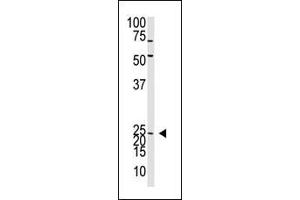 The Neurogenin2 N-term polyclonal antibody (ABIN388769 and ABIN2839073) is used in Western blot to detect Neurogenin2 in mouse liver tissue lysate. (Neurogenin 2 Antikörper  (C-Term))