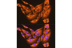 Immunofluorescence analysis of U-2 OS cells using PDI Rabbit mAb (ABIN7269615) at dilution of 1:100 (40x lens). (PDIA6 Antikörper)