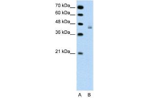 WB Suggested Anti-DHX30  Antibody Titration: 0. (DHX30 Antikörper  (N-Term))