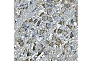 IHC analysis of CD97/Adgre5 using anti-CD97/Adgre5 antibody (ABIN7601103). (ADGRE5 (AA 287-816) Antikörper)