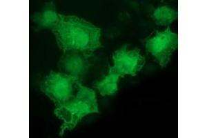 Anti-LMCD1 mouse monoclonal antibody (ABIN2454492) immunofluorescent staining of COS7 cells transiently transfected by pCMV6-ENTRY LMCD1 (RC200062). (LMCD1 Antikörper)