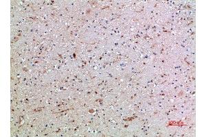 Immunohistochemical analysis of paraffin-embedded human-brain, antibody was diluted at 1:200 (CD16a, CD16b (AA 100-150) Antikörper)