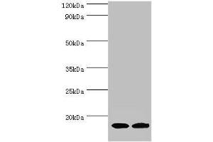 Western blot All lanes: Complexin-2 antibody at 6 μg/mL Lane 1: Rat brain tissue Lane 2: A549 whole cell lysate Secondary Goat polyclonal to rabbit IgG at 1/10000 dilution Predicted band size: 15 kDa Observed band size: 15 kDa (CPLX2 Antikörper  (AA 1-134))
