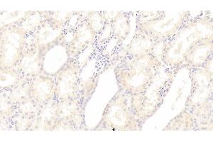 Detection of SGPL1 in Human Kidney Tissue using Polyclonal Antibody to Sphingosine 1 Phosphate Lyase 1 (SGPL1)