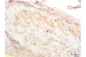 Formalin-fixed and paraffin embedded rat stomach muscle labeled with Anti-CNN2 Polyclonal Antibody, Unconjugated (ABIN1385667) at 1:200 followed by conjugation to the secondary antibody and DAB staining. (CNN2 Antikörper  (AA 118-150))