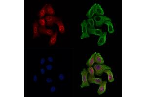 Phospho-WEE1 (Ser123) Antibody staining Hela cells(heat shock treatment) by IF/ICC. (WEE1 Antikörper  (pSer123))