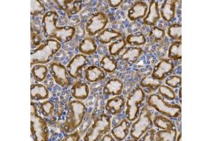 IHC analysis of SLC2A9 using anti-SLC2A9 antibody (ABIN7602338).