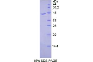 SDS-PAGE analysis of Dog beta 2-Microglobulin Protein.