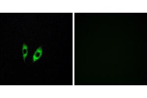 Immunofluorescence analysis of HeLa cells, using GP antibody.