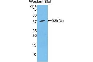Western blot analysis of the recombinant protein. (Annexin V Antikörper  (AA 1-319))