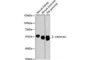 Western blot analysis of extracts of various cell lines using CRISPLD2 Polyclonal Antibody at dilution of 1:3000. (CRISPLD2 Antikörper)