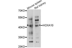 Western blot analysis of extracts of various cell lines, using HOXA10 antibody (ABIN5995981) at 1/1000 dilution. (HOXA10 Antikörper)