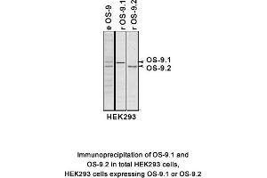 Image no. 2 for anti-Osteosarcoma Amplified 9, Endoplasmic Reticulum Lectin (OS9) (AA 300-400), (Isoform 1) antibody (ABIN363453)
