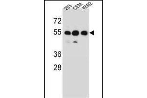 ZN Antibody (N-term) (ABIN656601 and ABIN2845861) western blot analysis in 293,CEM,K562 cell line lysates (35 μg/lane). (ZNF562 Antikörper  (N-Term))
