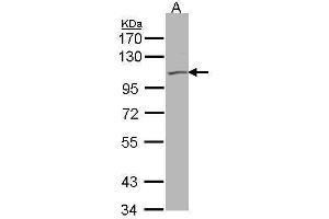 WB Image Sample(30 μg of whole cell lysate) A:293T 7. (KCNQ5 Antikörper)