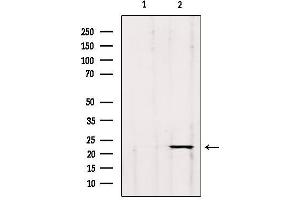 Western blot analysis of extracts from hybridoma cells, using GP1BB Antibody.
