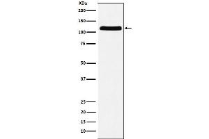Western blot analysis of E1 Ubiquitin Activating Enzyme expression in HeLa cell lysate.