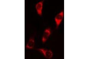 ABIN6269287 staining HeLa? (Caspase 9 Antikörper  (Internal Region))
