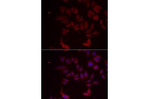Immunofluorescence analysis of MCF-7 cell using RPL11 antibody. (RPL11 Antikörper)