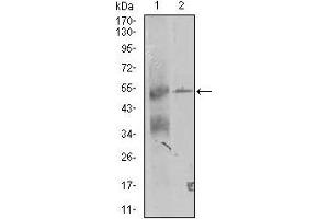 Western blot analysis using TRIP6 mouse mAb against K562 and A431 (2) cell lysate. (TRIP6 Antikörper  (AA 107-291))