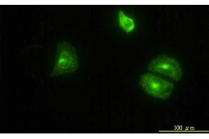 Immunofluorescence (IF) image for anti-Clathrin, Light Chain B (CLTB) (AA 1-211) antibody (ABIN560415)