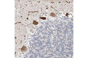 Immunohistochemical staining of human cerebellum with STARD9 polyclonal antibody  shows strong cytoplasmic positivity in purkinje cells. (STARD9 Antikörper)