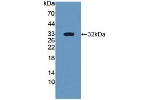Detection of Recombinant NID2, Human using Polyclonal Antibody to Nidogen 2 (NID2) (NID2 Antikörper  (AA 31-289))