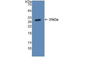 Western blot analysis of recombinant Human ASGR1. (Asialoglycoprotein Receptor 1 Antikörper  (AA 77-289))