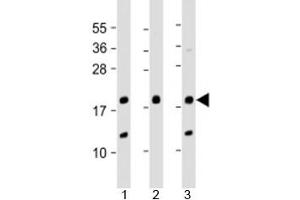 Western blot testing of human 1) A431, 2) SK-BR-3 and 3) U-2OS cell lysate with THRSP antibody at 1:2000.