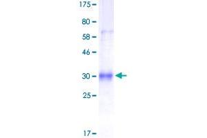 Image no. 1 for Tumor Necrosis Factor Receptor Superfamily, Member 11a, NFKB Activator (TNFRSF11A) (AA 30-212) protein (His-DYKDDDDK-Strep II Tag) (ABIN1323151) (TNFRSF11A Protein (AA 30-212) (His-DYKDDDDK-Strep II Tag))