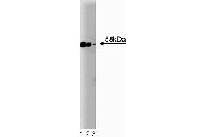 Western blot analysis of Smad2/3 on Jurkat cell lysate. (Smad2/3 Antikörper  (AA 142-263))
