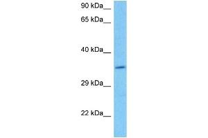 Host:  Mouse  Target Name:  DAZL  Sample Tissue:  Mouse Brain  Antibody Dilution:  1ug/ml (DAZL Antikörper  (C-Term))