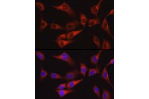 Immunofluorescence analysis of NIH/3T3 cells using FAK Rabbit pAb (ABIN6134667, ABIN6146423, ABIN6146425 and ABIN6215105) at dilution of 1:100 (40x lens). (FAK Antikörper  (AA 700-800))