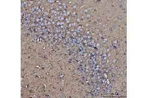 IHC analysis of CD90/Thy1 using anti-CD90/Thy1 antibody (ABIN5518877). (CD90 Antikörper  (AA 20-131))