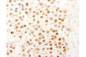 Immunohistochemistry (IHC) image for anti-Nuclear Transcription Factor Y, gamma (NFYC) (AA 408-458) antibody (ABIN7454434)